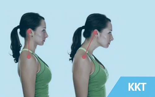 Neck Pain Posture