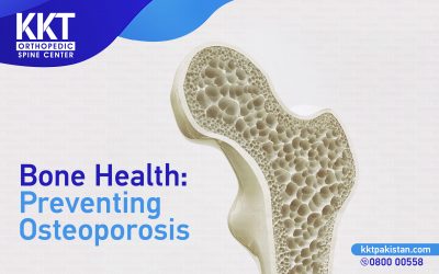 Bone Health: Preventing Osteoporosis