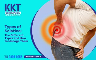 Types of Sciatica: The Different Types and How to Manage Them