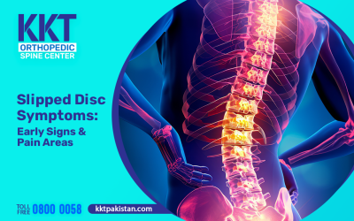 Slipped Disc Symptoms: Early Signs, Pain Areas, and What to Watch For